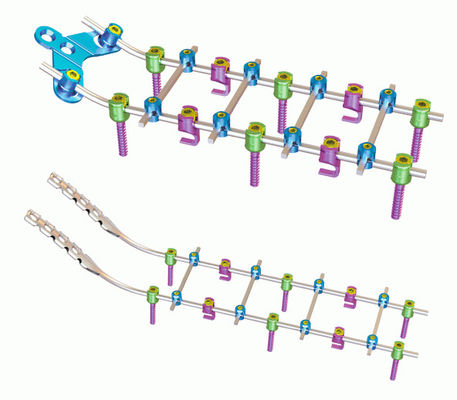 Later Cervicaal de Bevestigingssysteem van de titaniumorthopedie
