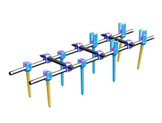 Ruggegraats de Bevestigingssysteem van de orthopedieⅣ Ruggegraats Intern Bevestiging