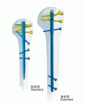 De chirurgische Met elkaar verbindende Spijker van het Orthopedie Anatomische Opperarmbeen