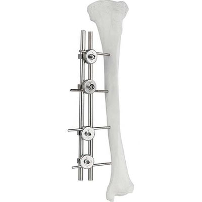 Orthopedische Implant het Beenchirurgie Fixator van Dijbeen Tibial Externe Fixator