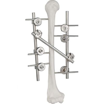 Het Apparaten Orthopedische Chirurgische Implant van de titanium Humeral Externe Bevestiging