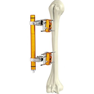 Medische Orthopedische Chirurgische Instrumenten Humeral Schacht Externe Fixator