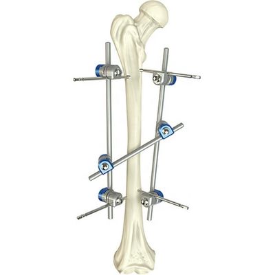 Fundamenteel Orthopedisch Extern de Bevestigingsapparaat van de Instrumenten Vastgesteld Chirurgisch Dijschacht
