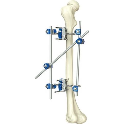 Uitstekende Orthopedische het Scheenbeen van het Kwaliteitsinstrument & van Percone Externe Fixator Orthopedische Chirurgische Instrumenten