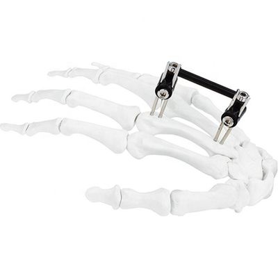 Orthopedisch Chirurgisch Mini Fragment Ilizarov External Fixation-Apparaat
