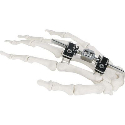 Orthopedisch Chirurgisch Mini Fragment Ilizarov External Fixation-Apparaat