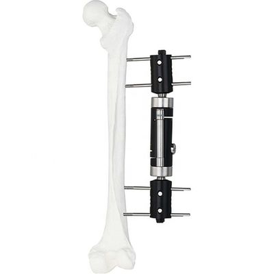 Orthopedisch Medisch Implant Recht Type Extern Ex de Moeilijke situatiehulpmiddel van Fixator