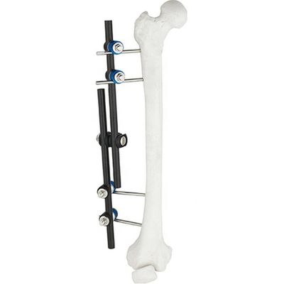 Hete Tibial Verkoop Orthopedische Chirurgische Instrumenten & Extern de Bevestigings Orthopedisch Instrument van Dijbeen Extern Fixator AO