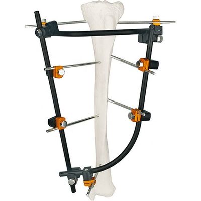 Uitstekend Instrument reeks-Iii van Fixator van Kwaliteits Orthopedisch Chirurgisch Instrumenten Extern Reeks van het Instrumenten de Medische Titanium