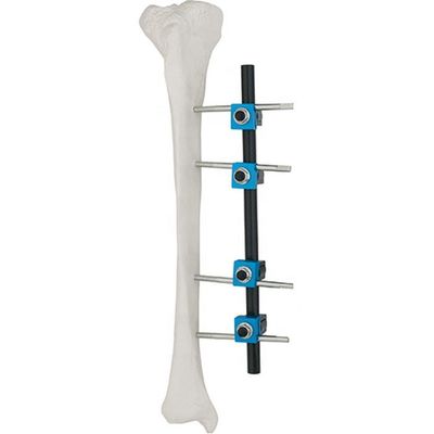 Condylar Extern Bevestigingsapparaat
