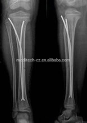 Orthopedische Implants TEN Titanium Elastische Spijker voor Kinderenchirurgie