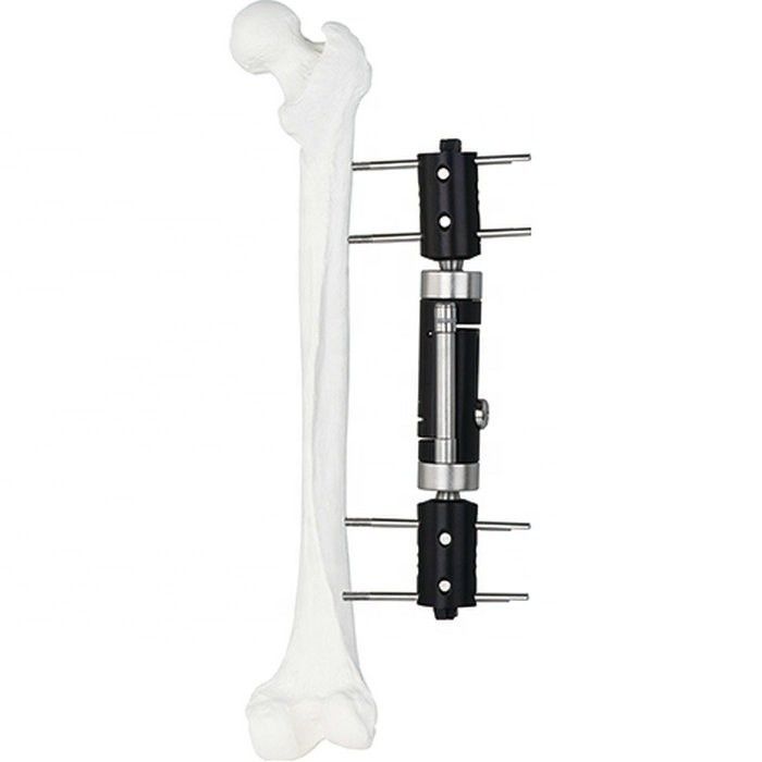 Orthopedisch Medisch Implant Recht Type Extern Ex de Moeilijke situatiehulpmiddel van Fixator