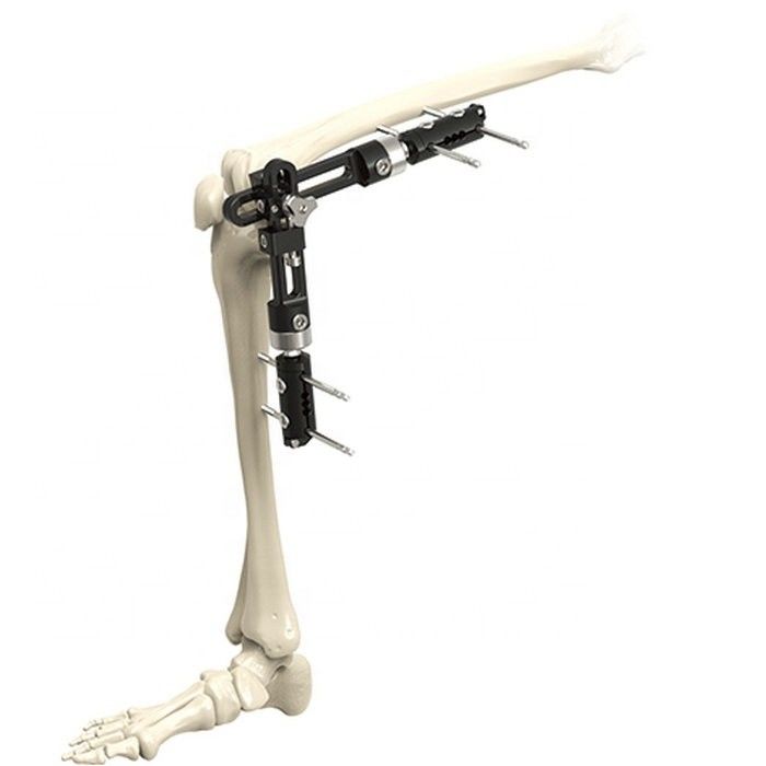 Hoog - van de Knie Gezamenlijke Externe Fixator van kwaliteits de Orthopedische Chirurgische Instrumenten Externe Bevestiging Orthopedische Chirurgische Instrumen