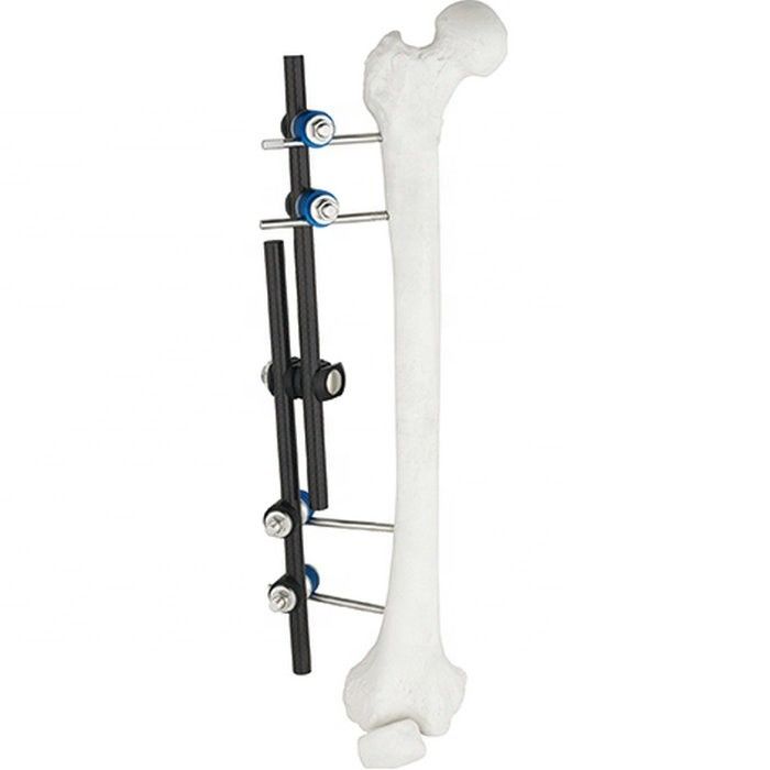 Hete Tibial Verkoop Orthopedische Chirurgische Instrumenten & Extern de Bevestigings Orthopedisch Instrument van Dijbeen Extern Fixator AO