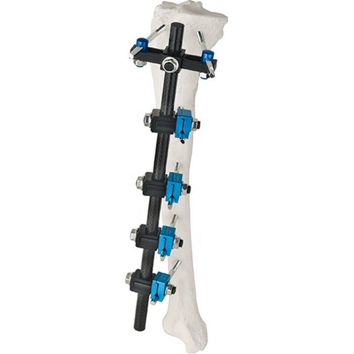 Van de Instrumenten Tibial Externe Fixator AO van de fabrieksprijs Orthopedische Chirurgische Externe de Bevestigings Orthopedische Implant